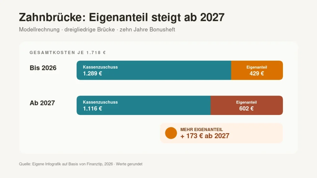Vergleich des Eigenanteils einer Zahnbrücke mit etwa 429 Euro bis 2026 und 602 Euro ab 2027